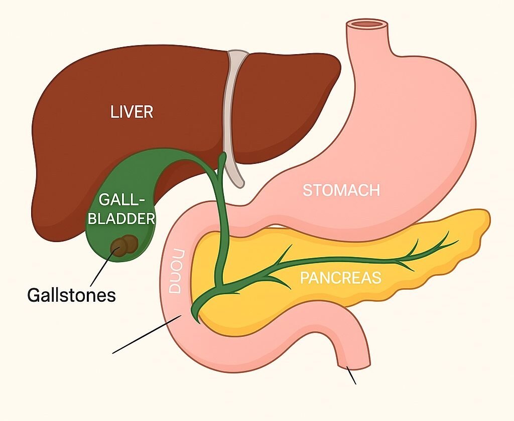 Laparoscopic gall bladder surgery by Dr Parul Garg robotic surgeon in Mohali treating patients from Srinagar and Jammu Kashmir