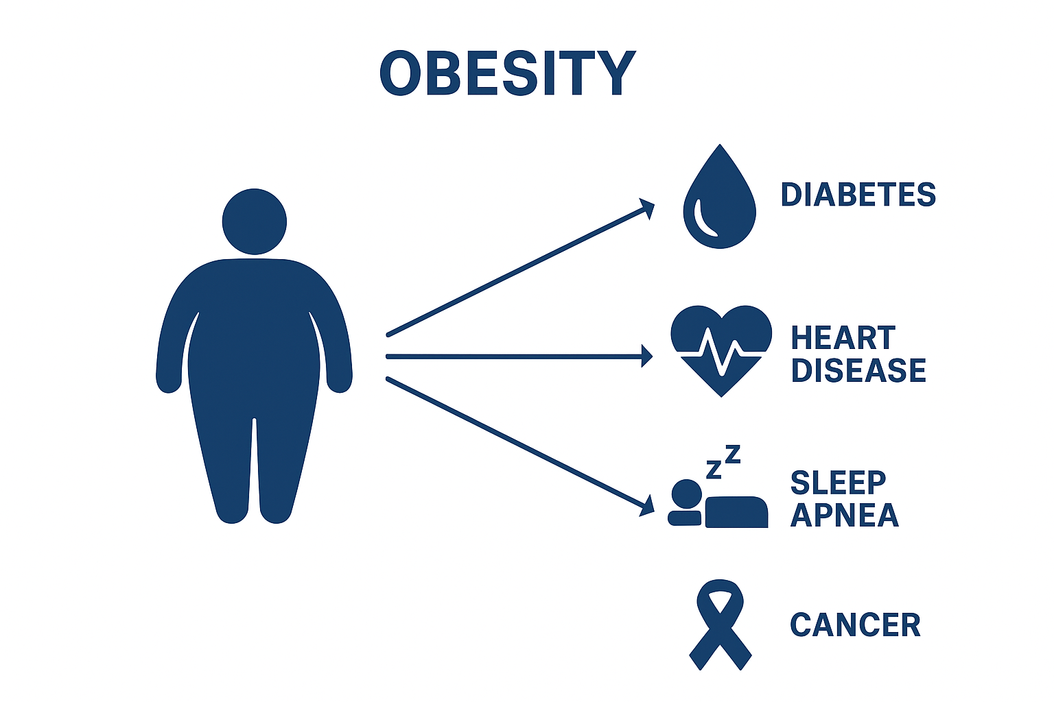 Bariatric surgery stomach reduction illustration showing weight loss surgery procedure